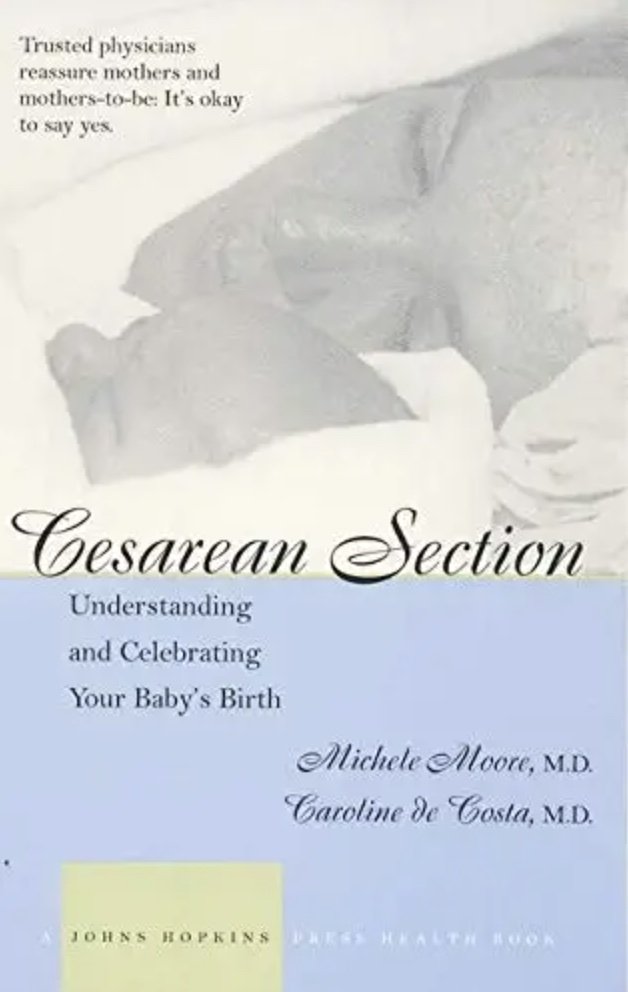 Cesarean Section: Understanding and Celebrating Your Baby's Birth